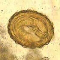 تخم بارور شده آسکاریس لومبریکوئیدس