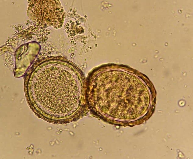 تخم بارور شده آسکاریس لومبریکوئیدس