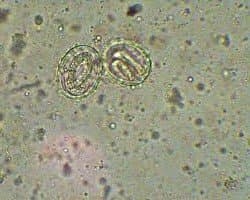 تخم بارور شده آسکاریس لومبریکوئیدس