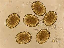 تخم بارور شده آسکاریس لومبریکوئیدس