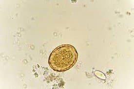 تخم بارور شده آسکاریس لومبریکوئیدس