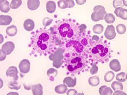 پدیده تجمع اقماری پلاکت‌ها در اطراف لکوسیت‌های نوتروفیل