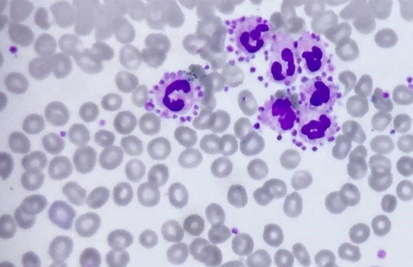 پدیده تجمع اقماری پلاکت‌ها در اطراف لکوسیت‌های نوتروفیل