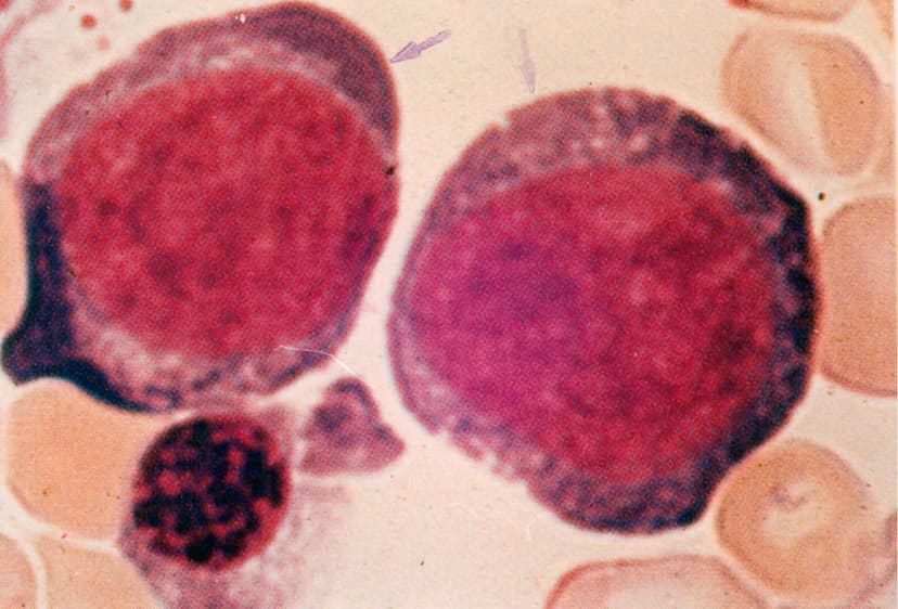 پرونورموبلاست (14-19) میکرون