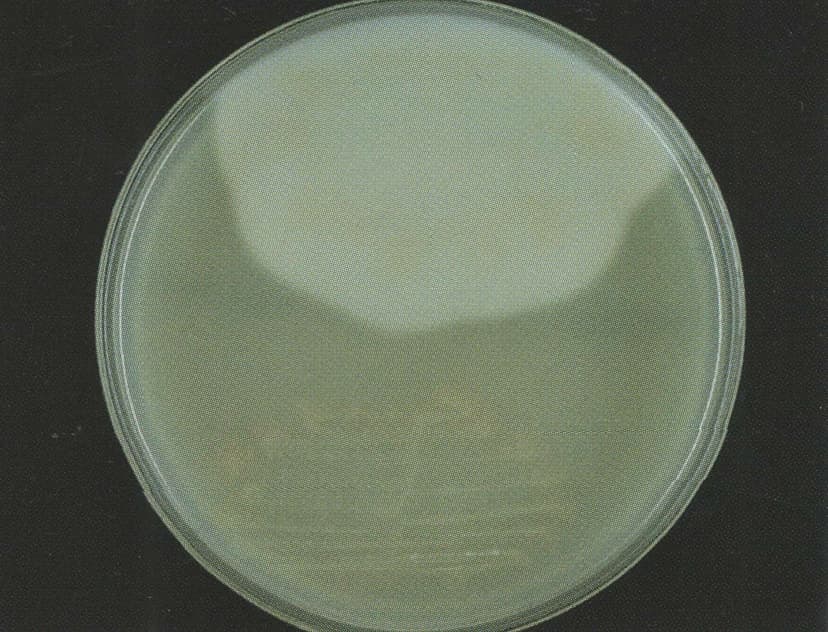 کلستریدیوم دیفیسیل و کلستریدیوم پرفرنجنس بر روی آگار زرده تخممرغ