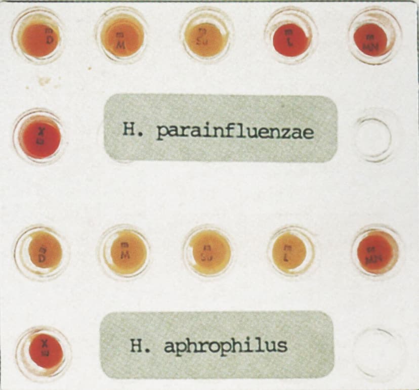شناسایی هموفیلوس پاراآنفلوانزا و هموفیلوس افروفیلوس (H.aphrophilus) با روش قندهای مینی تـک (Minitek sugars)