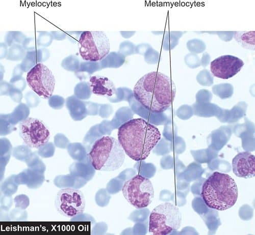 متامیلوسیت