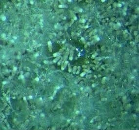 آسپرژیلوس ترئوس