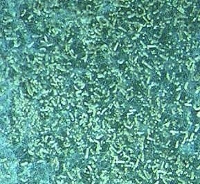 آسپرژیلوس ترئوس