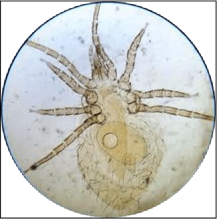 جنس اورنیتونیسوس