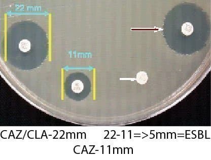 تشخيص فنوتيپی كلبسيلا پنومونيه مولد بتالاكتاماز وسيع الطيف(ESBL) با استفاده از روش كربی بائر